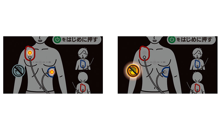 操作アシスト機能