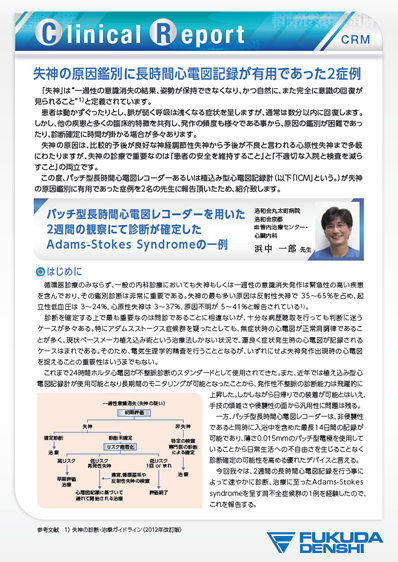 長時間心電図モニタリングの有用性と臨床的意義