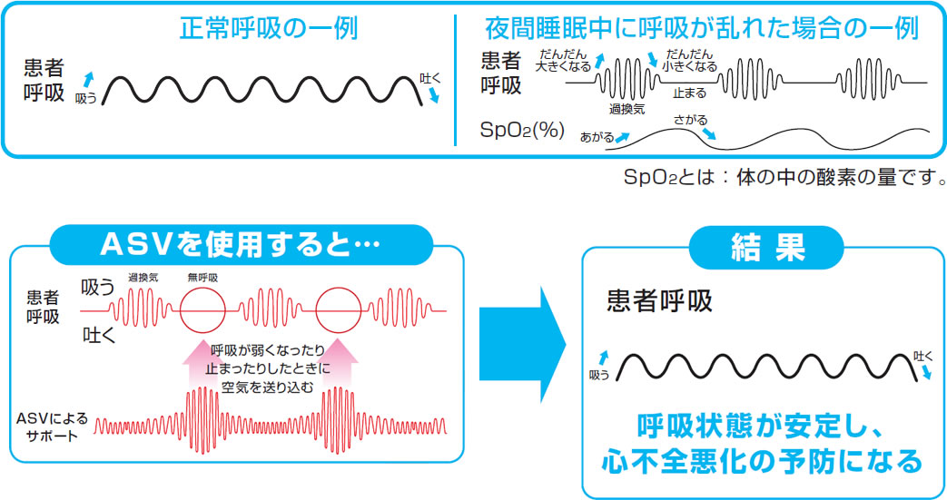 チェーン ストーク 呼吸