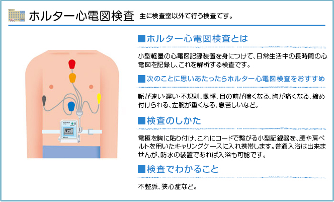 ホルター心電図検査の説明