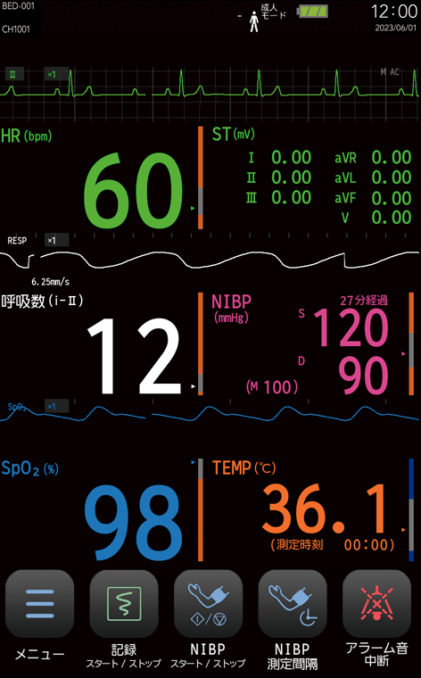 ベッドサイドモニタ BDS-1001システム - フクダ電子