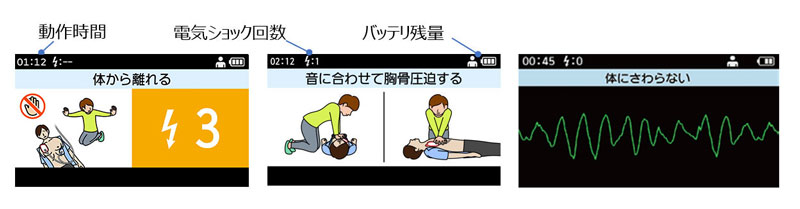 ダイナハートAED S1D | フクダ電子