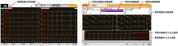 解析付心電計 FCP-9900 | フクダ電子