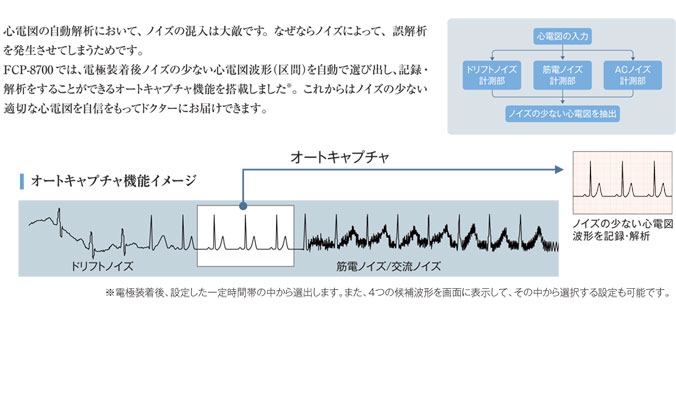 心電図で診る・治す 虚血性心疾患：狭心症の診断と治療 – 医療法人恵山会 丸山病院