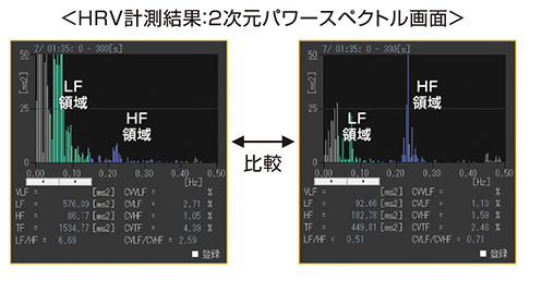 実力心電図 「読める」のその先へ改訂版 : 有隣堂ヤフー
