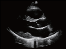 超音波画像診断装置 Lumify | フクダ電子