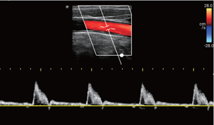 超音波画像診断装置 Lumify | フクダ電子