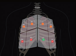 超音波画像診断装置 Lumify | フクダ電子