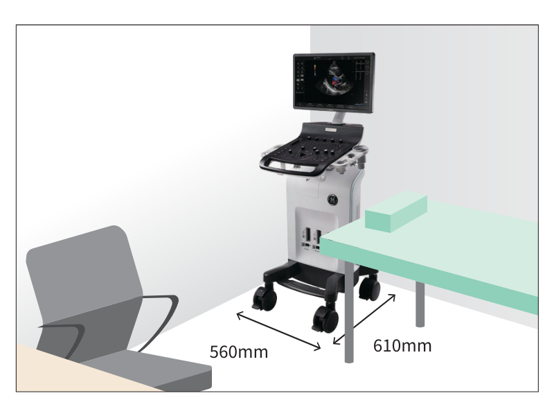汎用超音波画像診断装置 Versana Essential R2 | フクダ電子