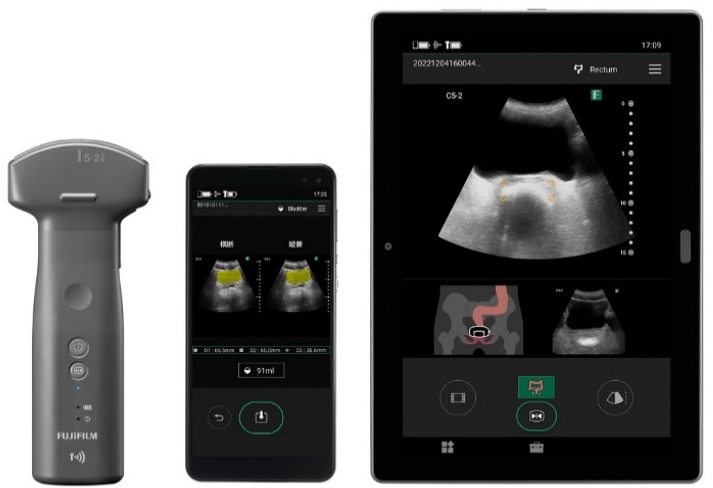 超音波画像診断装置 iViz air コンベックス | フクダ電子