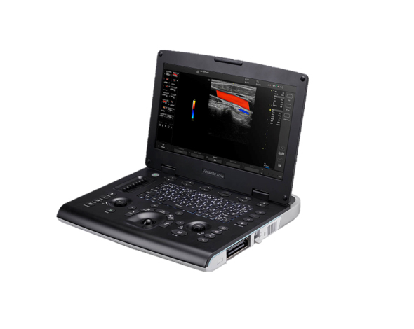 超音波　画像診断　ノートパソコン型　エコー US（超音波診断装置） | コニカミノルタ
