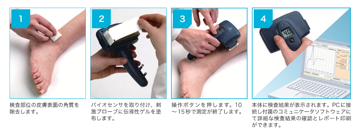 神経伝導検査装置DPNチェック HDN-1000 | フクダ電子