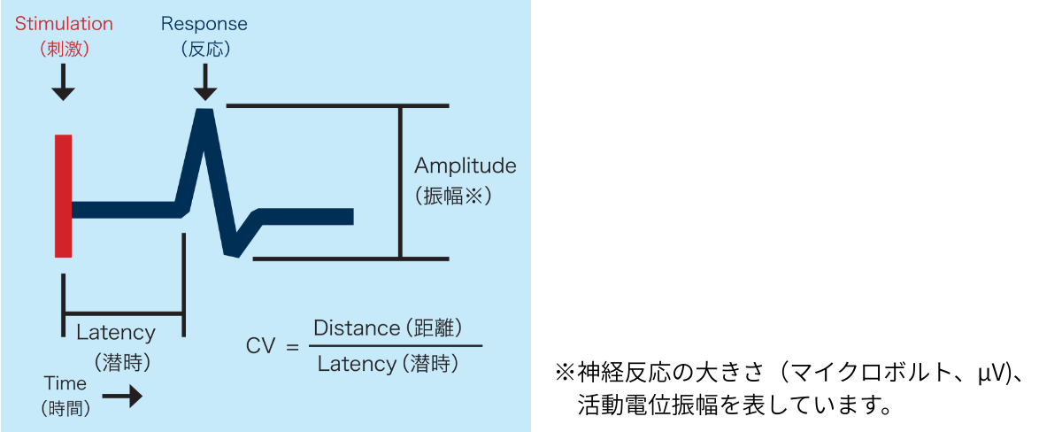 神経伝導検査装置DPNチェック HDN-1000 | フクダ電子