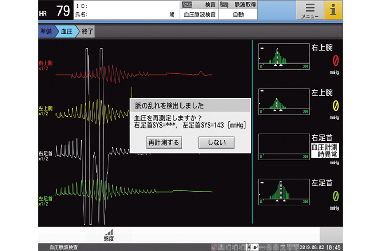 血圧脈波検査装置 VS-2000 ADVANCE 特設ページへ | フクダ電子