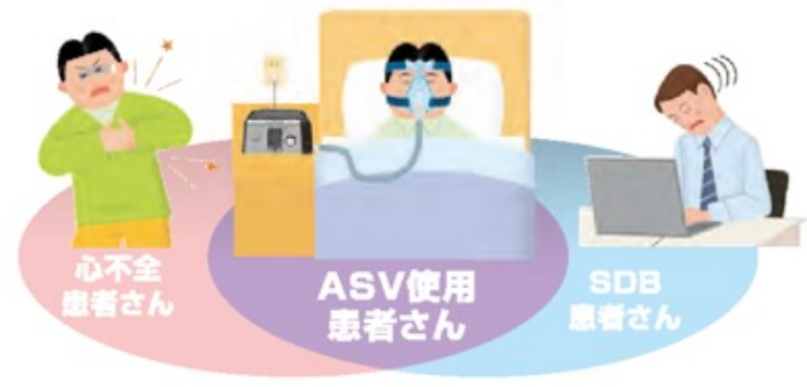 心不全患者さん　ASV使用患者さん　SDB患者さん